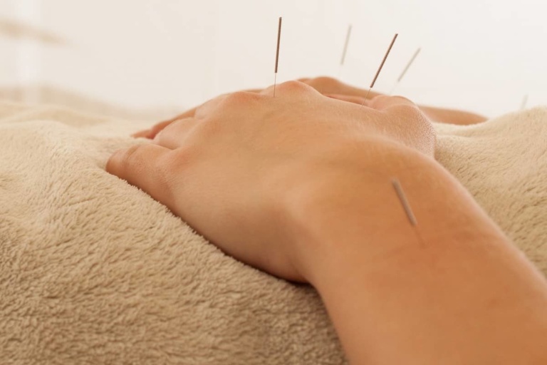 Acupuntura para diminuir efeitos colaterais do câncer de mama